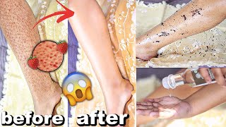 GET RID OF STRAWBERRY LEGS & GET SMOOTH CLEAR LEGS IN 1 DAY | Kareena Malik