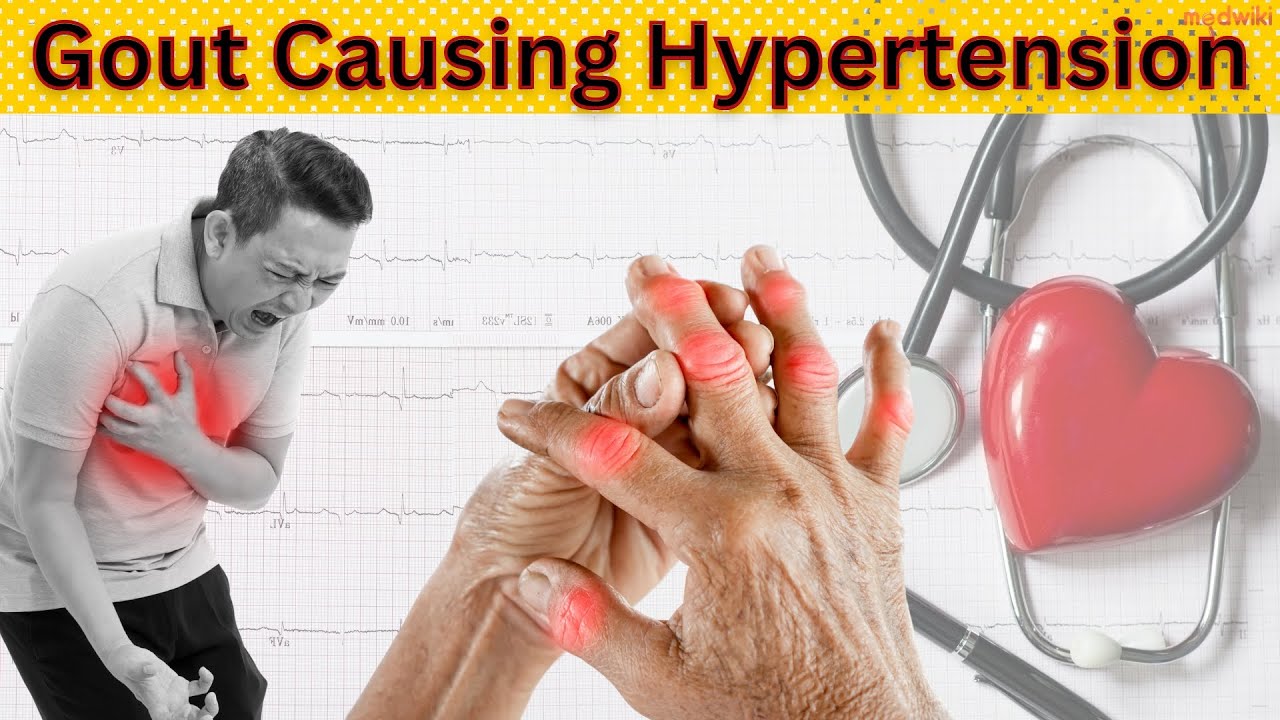 The Surprising Link Between Gout and High Blood Pressure!