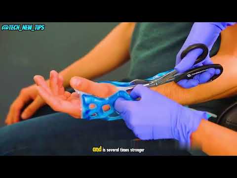 Say Goodbye to Traditional Casts