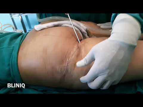 Patient Recovery Case — Video 37 (Facial Aesthetics)