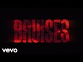 Videoklip Lewis Capaldi - Bruises (Lyric Video)  s textom piesne