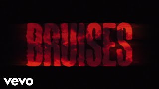 Lewis Capaldi - Bruises (Lyric Video) - YouTube
