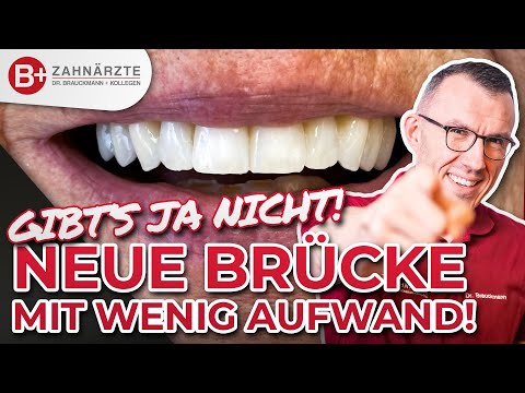 Ganz einfach: Zahnbrücke unkompliziert neu gemacht! Brücke für die Frontzähne mit Vorher-Nachher!