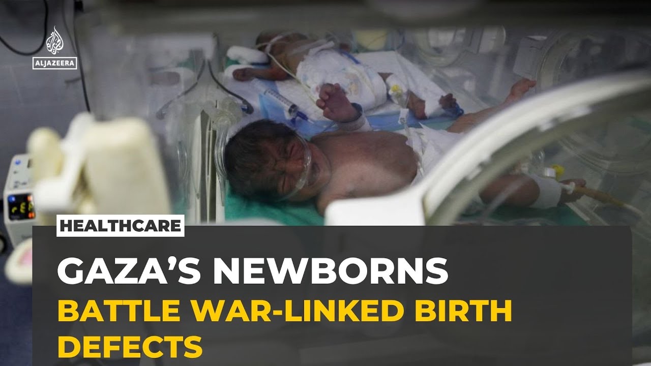 Gaza’s fragile survivors: Newborns battle war-linked birth defects