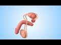 How To Use A Condom Nucleus Health