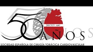 SECTCV 50 Aniversario   50 Años del primer trasplante cardiaco