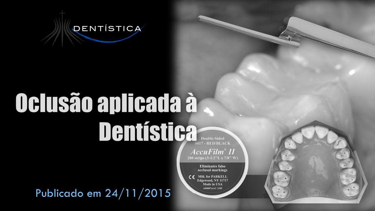 Oclusão aplicada à Dentística