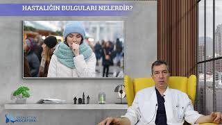 Corona Virüs Hastalığının Bulguları Nelerdir?