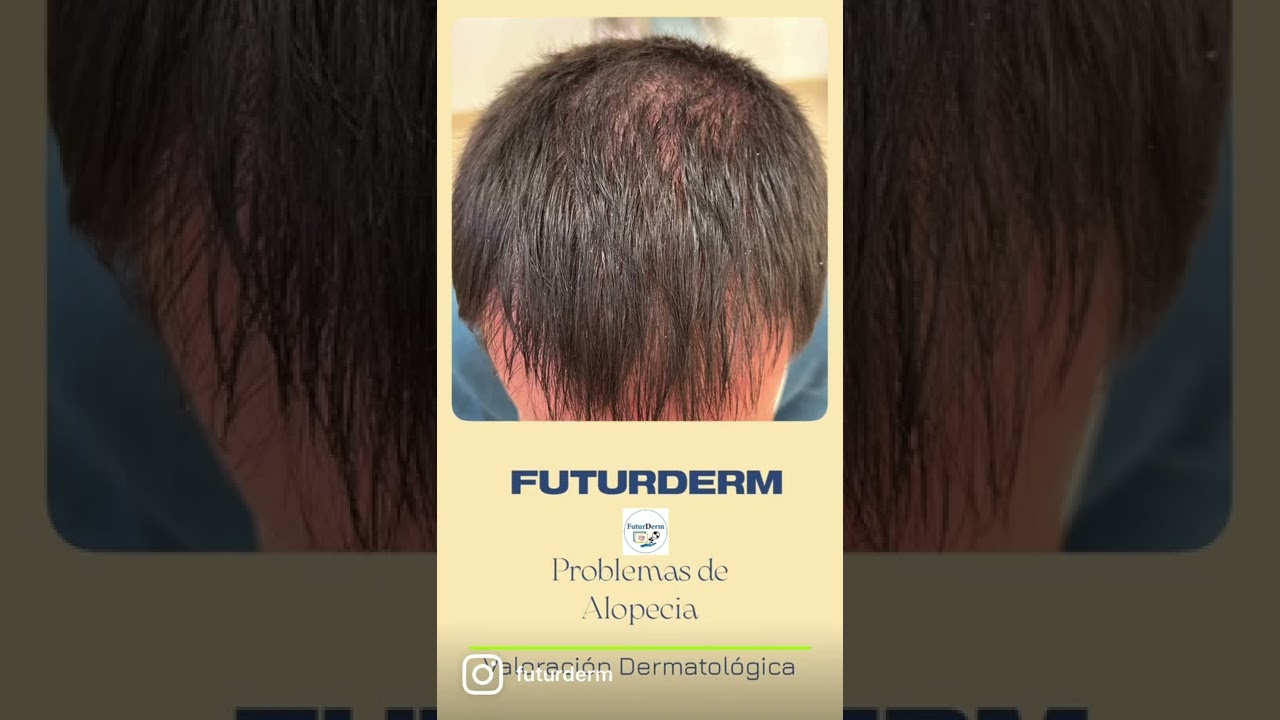 Miguel Angel Flores Terry-13