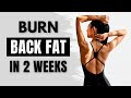 GET RID OF BACK FAT in 2 WEEKS 🔥 8 MIN Standing Workout | Bra Bulge, Armpit Fat