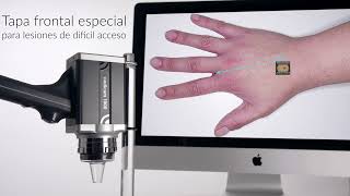 Videocámara Full HD Medicam 1000s - la admiración de los dermatoscopistas en todo el mundo