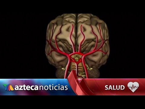 ¿Por qué se dan las embolias y cómo evitarlas?