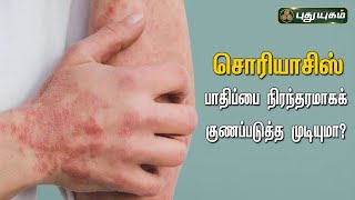 Doctor On Call 09-02-2023 PuthuYugam tv Show