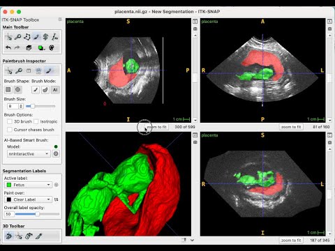 Preview of the ITK-SNAP deep learning segmentation demonstration