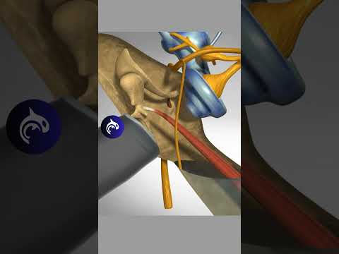 See Inside A Middle Ear Infection🦻✨