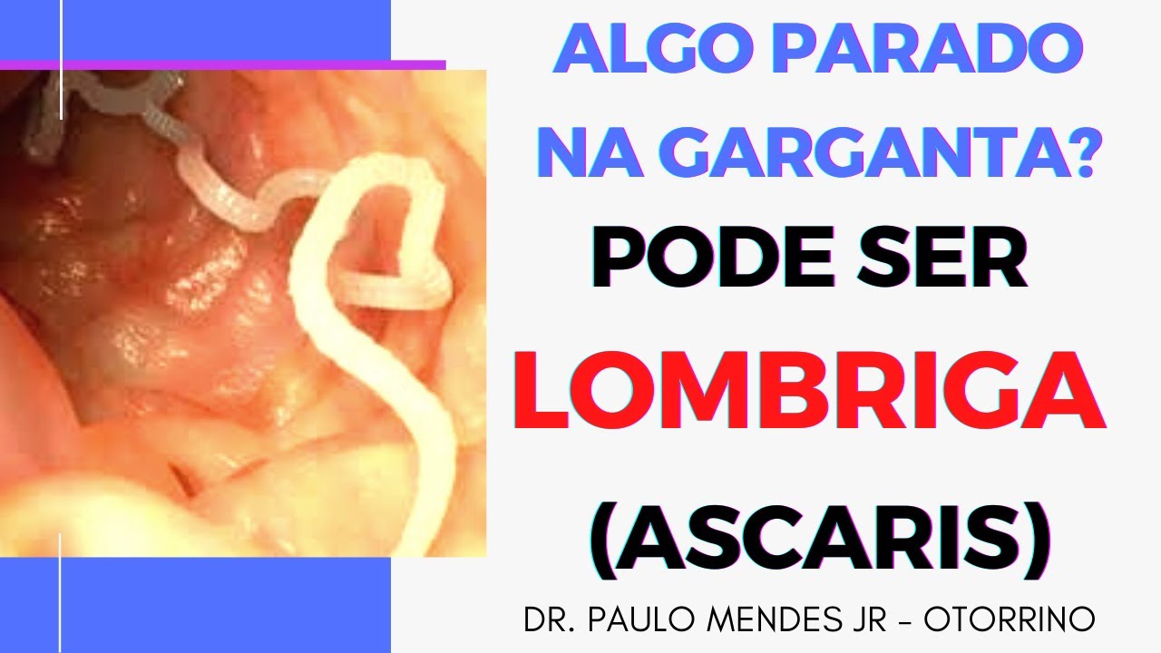 LOMBRIGA NA GARGANTA? Algo preso na garganta ou sensaçāo de bolo pode ser (verme ascaris)?