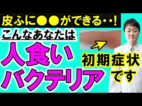 化膿レンサ球菌の顕微鏡写真