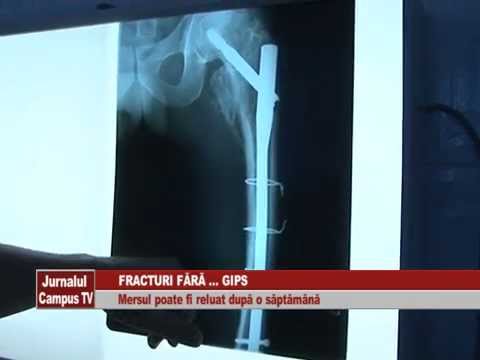 Osteoartroza tratamentului articulațiilor costale transversale