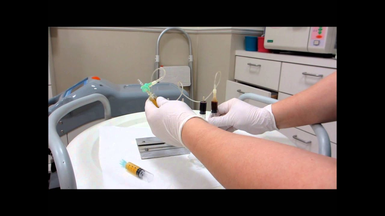 A safe and ecomonic method for preparing PRP (platelet rich plasma)