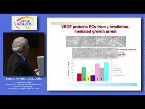 The Unfolded Protein Response in Tumor Growth and Angiogenesis: A Novel Target in Cancer Therapy