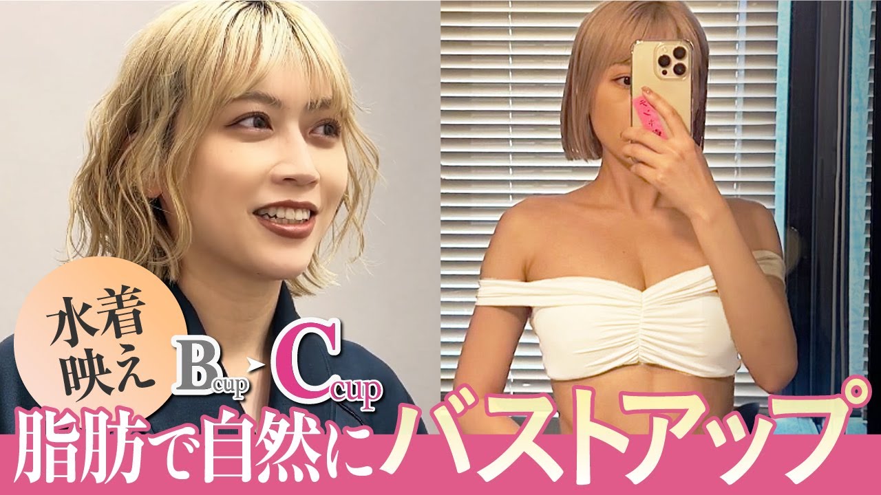 【体験談】脂肪注入豊胸でバストアップ|インフルエンサーtsukasaさんが叶えた理想のバストとは?