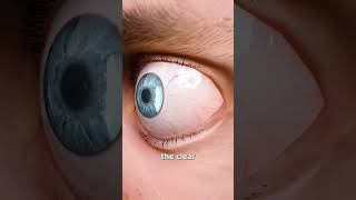 Download lagu When An Eyelash Gets Stuck In Your Eye 👁️😬 mp3