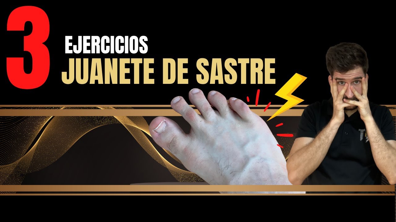 Watch 3 ejercicios para el juanete de sastre Now 3 ejercicios para el juanete de sastre