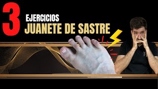 3 ejercicios para el juanete de sastre