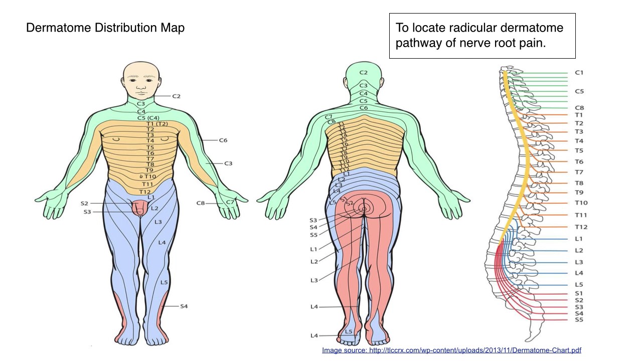 Interventional Spinal Procedures PPT