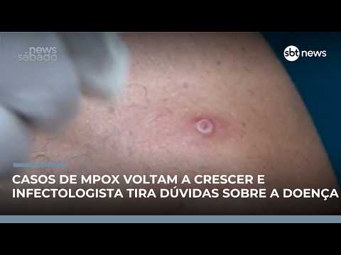 Brasil registra novos casos de Mpox em 2026 e acende alerta na saúde pública | #NewsSábado