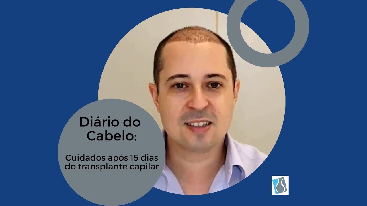 Diário do Cabelo - Episódio 4: Cuidados após 15 dias do transplante capilar