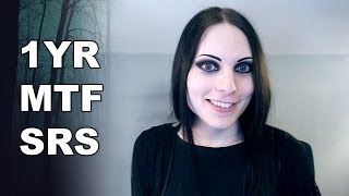 Sex Reassignment Surgery (SRS) | 1 Year Post-op Male to Female