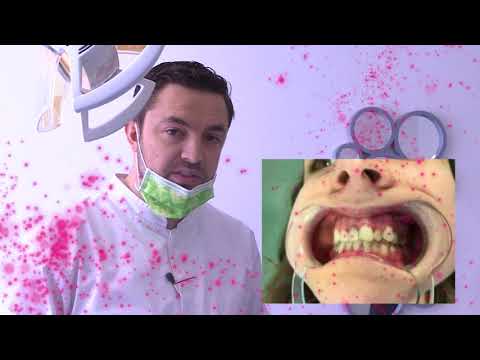 Metamorfoza nga Suzana - Episodi 28