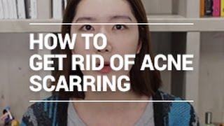 How to Get Rid of Acne Scarring | Wishtrend