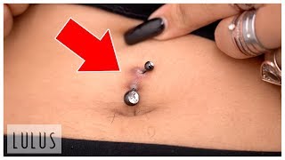 Does This Belly Piercing Look Infected To You??