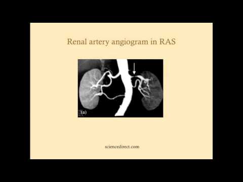Prerenal Failure - CRASH! Medical Review Series