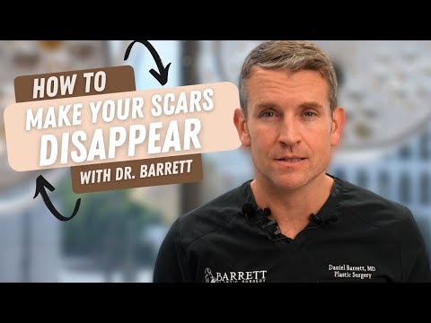 How To Make Your Scars Disappear! | Barrett Plastic Surgery