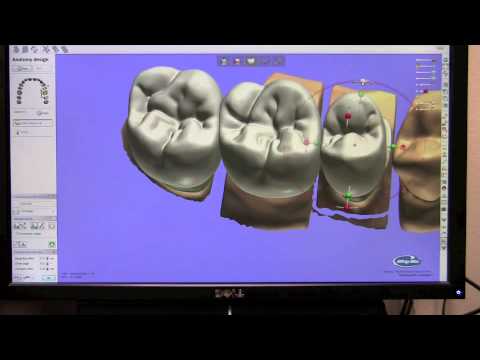 download lagu mp3 mp4 D700 3shape, download lagu D700 3shape gratis, unduh video klip D700 3shape