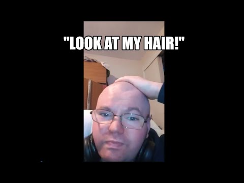 Arron Owen - The Skinhead.