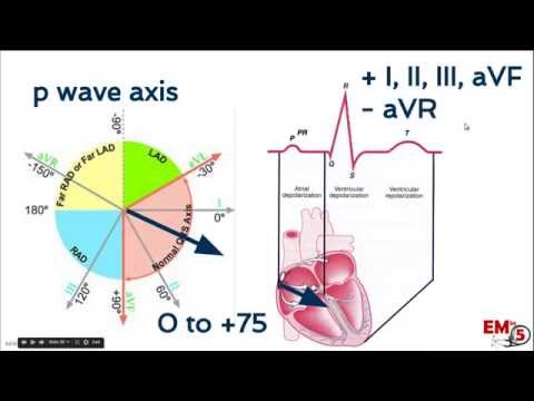 EKG interpretation  axis