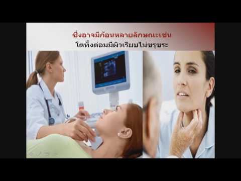 เต้านมเทียม Allergan Lindinet enlarge หน้าอก