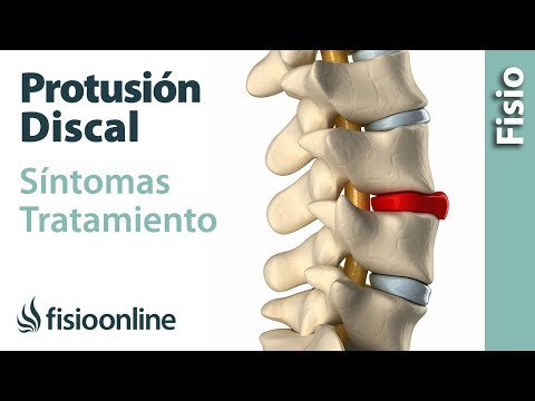 Protrusión de disco o discal - Qué es, causas, síntomas y tratamiento
