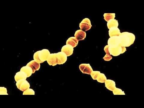 Negozio per massaggiatore della prostata Ecografia delle calcificazioni della prostata