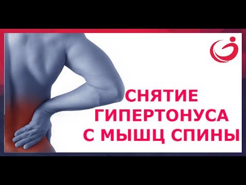 Лечение кифоза поясничного отдела Таблетки от боли в спине в пояснице