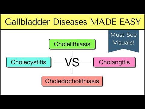 Cholecystitis vs Cholelithiasis vs Cholangitis vs Choledocholithiasis [Nursing, USMLE]