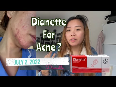 Dianette For Acne Review