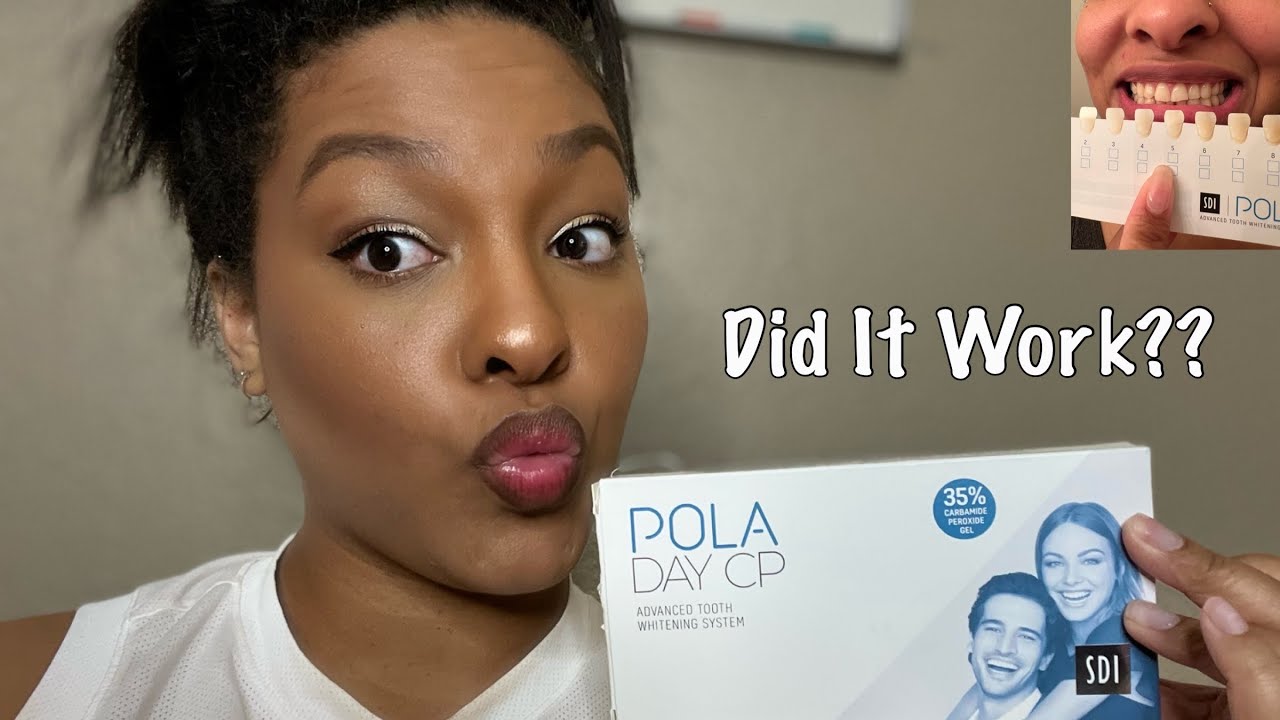 Pola Day Teeth Whitening Review