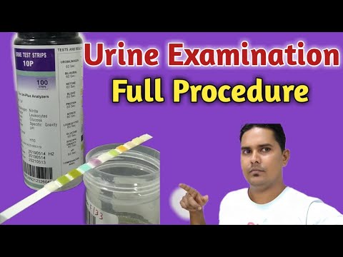 Urine Test Strips (Mission) 2GE (Glu+Pro/Diastix) (100T Pack)