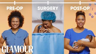 This is Your C-Section in 2 Minutes | Glamour