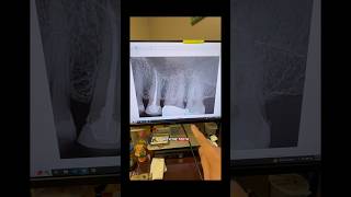 What’s your diagnosis? #dentists #dentalprosthesis #dentalcare #rootcanaltherapy #dentalartistry
